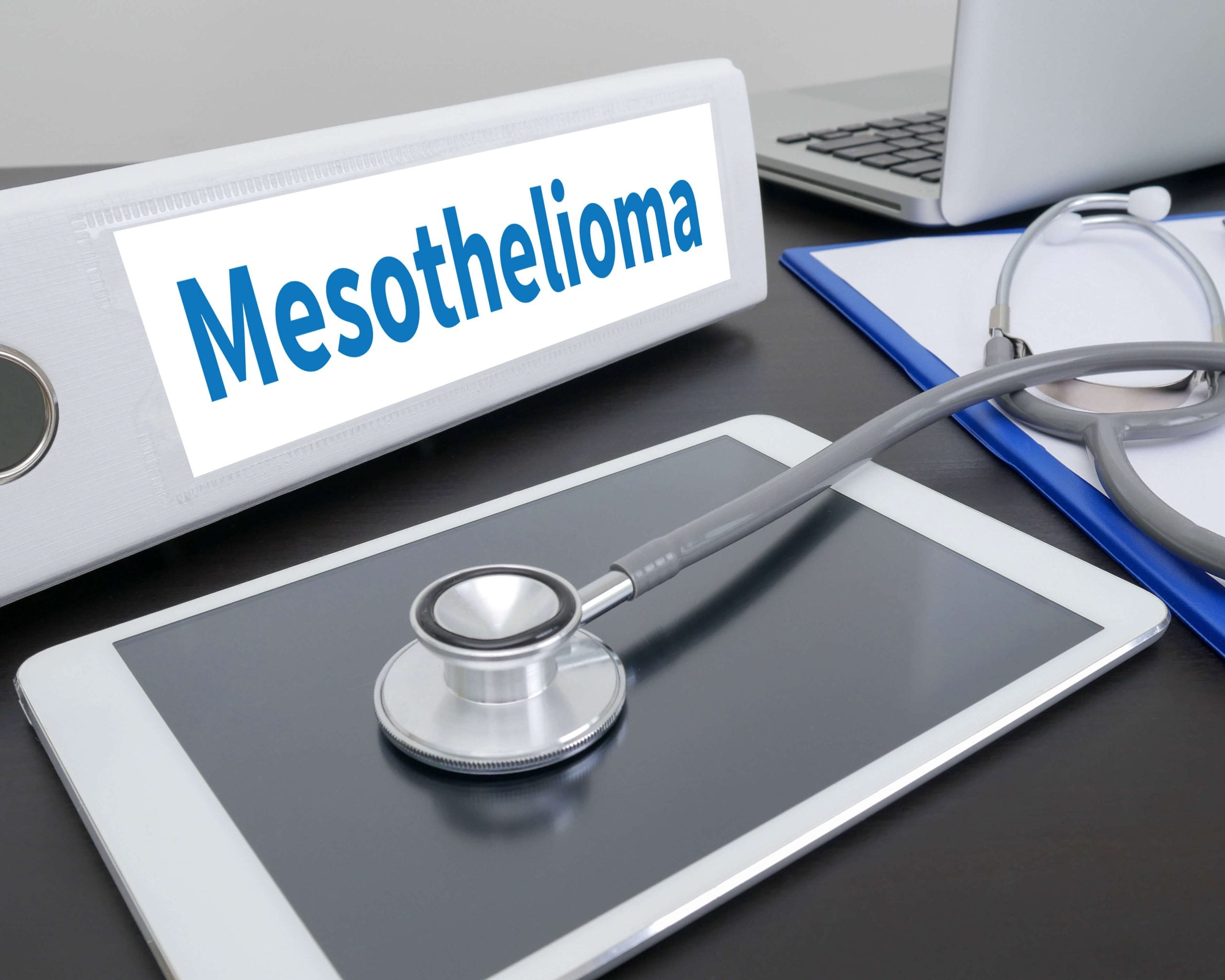 Stages-of-Mesothelioma in Des Moines